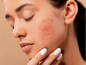 Skin care: दवा की जरूरत नहीं फिटकरी पाउडर से ही दूर हो जाएंगी सभी स्किन प्रॉब्लम्स, जानें इस्तेमाल का सही तरीका