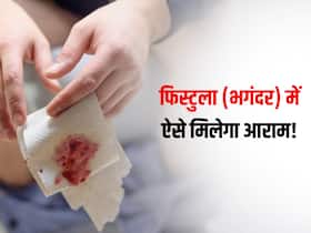 फिस्टुला में सर्जरी से ज्यादा कारगर होती है ये आयुर्वेदिक थेरेपी, जड़ से ठीक हो जाती है ये समस्या