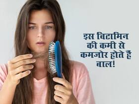 शरीर में इस विटामिन की कमी से बालों को होते हैं ये 3 नुकसान! जानें इस विटामिन की कमी को दूर करने वाले 5 फूड्स