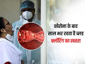 कोरोना के बाद 1 साल तक लोगों में ज्यादा रहता है ब्लड क्लॉटिंग का खतरा, शोध में सामने आई बात
