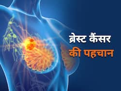 शुरुआत में ही हो सकेगी ब्रेस्ट कैंसर की पहचान, शोधकर्ताओं ने निकाला एक अनोखा तरीका