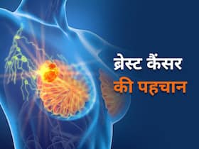 शुरुआत में ही हो सकेगी ब्रेस्ट कैंसर की पहचान, शोधकर्ताओं ने निकाला एक अनोखा तरीका