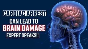 Cardiac Arrest: How Cardiac Arrest Can Lead To Brain Dysfunction, Expert Speaks, Watch Video