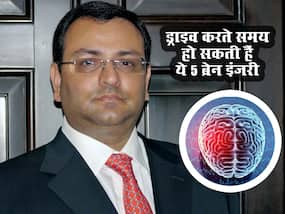 सिर पर चोट लगने से हुई साइरस मिस्त्री की मौत, ड्राइव करते वक्त एक नहीं इन 5 ब्रेन इंजरी का शिकार हो सकते हैं आप