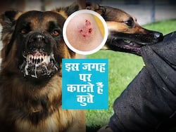 सबसे ज्यादा शरीर के इन हिस्सों पर काटते हैं कुत्ते, आप पर हुआ है हमला तो तुरंत करें ये काम