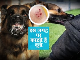सबसे ज्यादा शरीर के इन हिस्सों पर काटते हैं कुत्ते, आप पर हुआ है हमला तो तुरंत करें ये काम