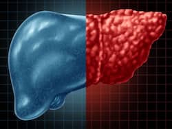 लिवर की गंदगी साफ करने का ये है 7 बेस्ट तरीका, जानिए लिवर को हेल्दी रखने का सबसे अच्छा तरीका
