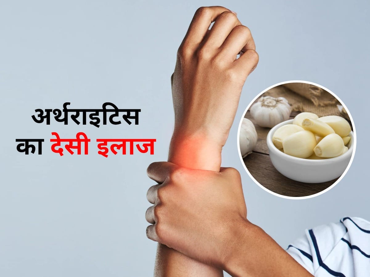 अर्थराइटिस के मरीज इन 5 तरह से करें लहसुन का इस्तेमाल, दर्द और सूजन से