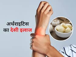 अर्थराइटिस के मरीज इन 5 तरह से करें लहसुन का इस्तेमाल, दर्द और सूजन से मिलेगी राहत
