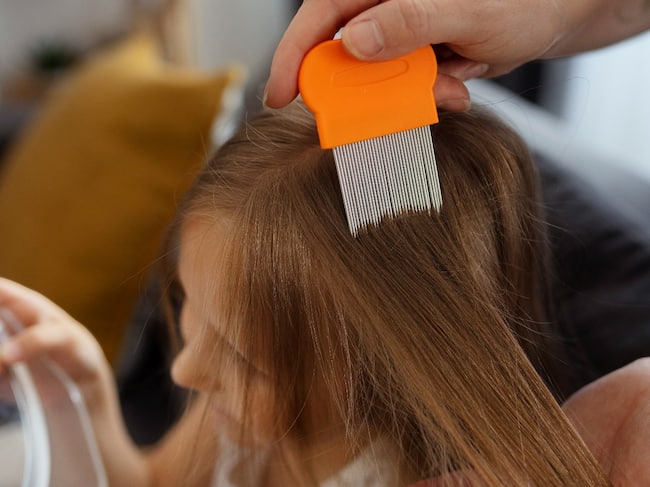 head-lice