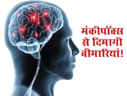 मंकीपॉक्स से संक्रमित होने पर लोग रहे इन दिमागी बीमारियों का शिकार! स्टडी से जानिए कितना सही ये दावा