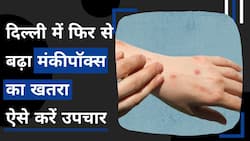 Monkeypox Cases: दिल्ली में मंकीपॉक्स का 9वां मामला आया सामने, कैसे करें उपचार, Watch Video