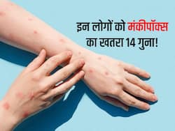 इन लोगों को है मंकीपॉक्स का 14 गुना ज्यादा खतरा! सीडीसी ने बताया क्योंकि जरूरी है वैक्सीनेशन