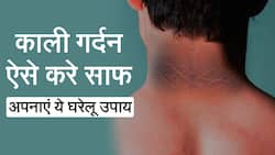 गर्दन काली पढ़ने की समस्या से हो गए हो परेशान? तो अपनाएं ये घरेलू उपाय, होगा जल्द असर, Watch Video