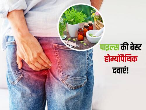 Homeopathic Medicine For Piles खूनी या बादी ये 5 दवाएं बवासीर में बिना साइड इफेक्ट्स पहुंचाती 