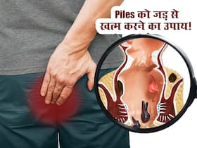 दिल्ली के बड़े आयुर्वेद डॉक्टर ने बताया पाइल्स को जड़ से खत्म करने का तरीका! बिना दवा दर्द-सूजन से मिलेगा आराम