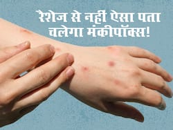 अब रैशेज नहीं बल्कि इन छिपे हुए संकेतों से लगेगा मंकीपॉक्स का पता! ICMR ने बताया कौन से सैंपल लेना जरूरी