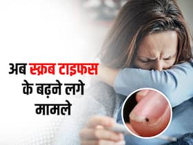दिल्ली में तेजी से बढ़ रहे हैं स्क्रब टायफस के मामले, जानें क्या है ये बीमारी और इस से बचाव का तरीका दिल्ली में तेजी से बढ़ रहे हैं स्क्रब टायफस के मामले, जानें क्या है ये बीमारी और इस से बचाव का तरीका