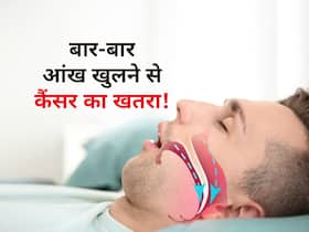 रात में बार-बार आंख खुलने से लोगों में इस बीमारी का खतरा! स्टडी में बताया नसों में बनने लगते हैं खून के थक्के