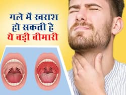 Tonsillitis: गले में हल्की खराश भी हो सकती है इस गंभीर बीमारी का लक्षण, जानें कैसे करें इसकी पहचान