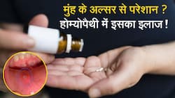 Homeopathy Treatment: होम्योपैथिक की दवा से मुंह के छालों का करें इलाज, Watch Video