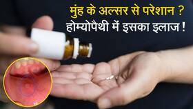 Homeopathy Treatment: होम्योपैथिक की दवा से मुंह के छालों का करें इलाज, Watch Video