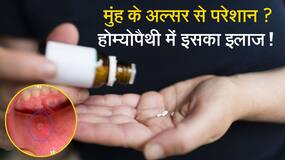 Homeopathy Treatment: होम्योपैथिक की दवा से मुंह के छालों का करें इलाज, Watch Video