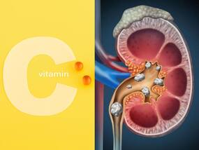 Vitamin C का अधिक सेवन बन सकता है Kidney Stone की वजह, जानिए एक दिन कितना विटामिन सी लेना है सही