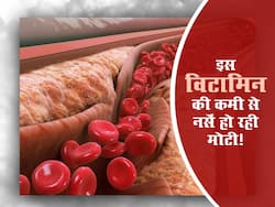 शरीर में इस विटामिन की कमी की वजह से कमजोर हो रही आपकी नसें! जानें नसें कमजोर होने के 10 लक्षण