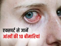 20 से 35 की उम्र के लोग में बढ़ रही हैं आंखों की ये 10 बीमारियां, कमजोर नजर के साथ बढ़ रहा है अंधापन