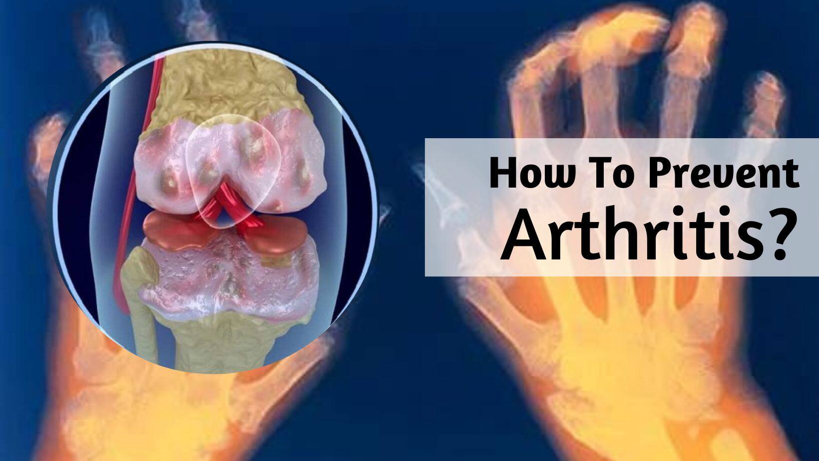 10 Things You Need to Stop Doing If You Have Arthritis