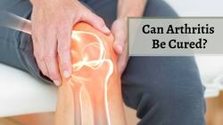 Can Arthritis Be Cured? Rheumatologist Answers What Makes This Condition Such A Big Health Challenge