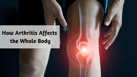 Heart Diseases To Fibromyalgia: Here Is How Arthritis Damages Other Organs of Your Body Heart Diseases To Fibromyalgia: Here Is How Arthritis Damages Other Organs of Your Body