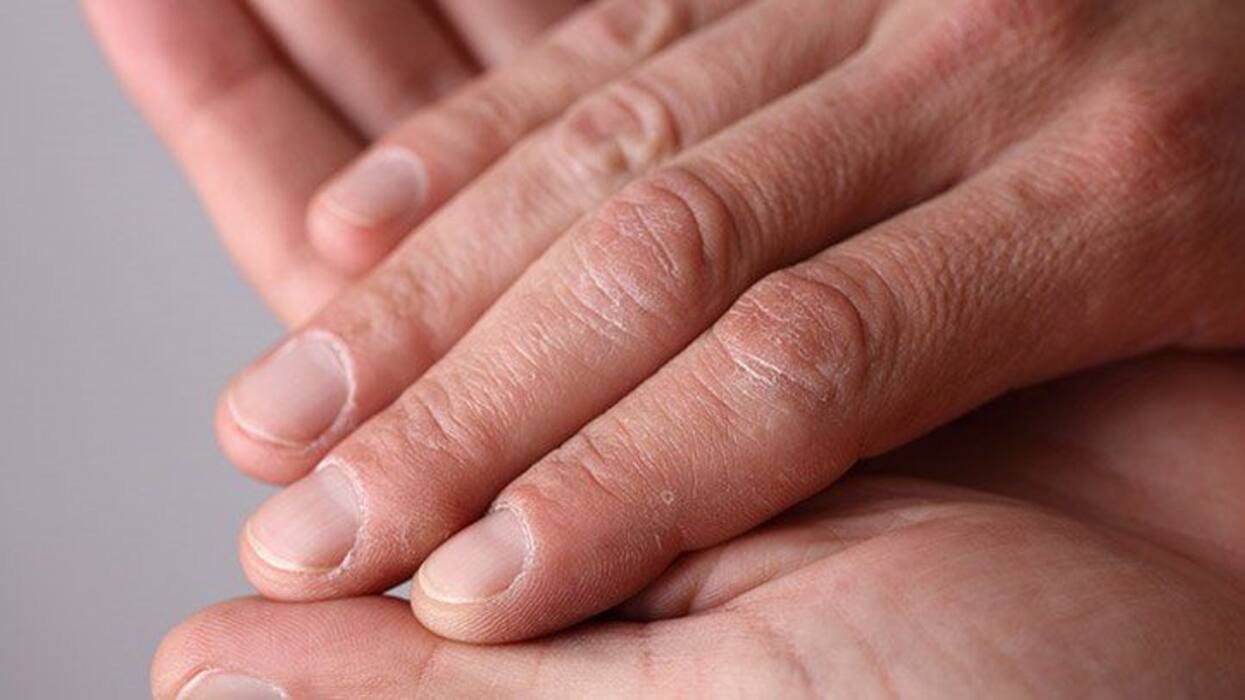 7 Unusual Symptoms of Zinc Deficiency