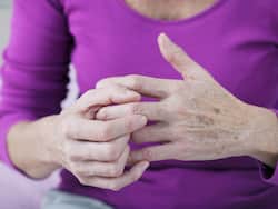 Arthritis: Myths, Facts And Prevention By Dr Sunitha Kayidhi