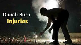 How To Deal With Burn Injuries While Celebrating Diwali