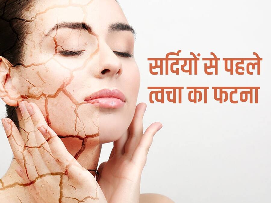 मौसम बदलते ही फटने लगी है आपकी स्किन? रात में सोने से पहले लगाएं ये 5 चीजें