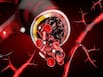 Sickle Cell Disease: Who Is Susceptible To Sickle Cell Anaemia?