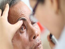 World Sight Day 2022: How Diabetic Retinopathy Is Treated In Homeopathy World Sight Day 2022: How Diabetic Retinopathy Is Treated In Homeopathy