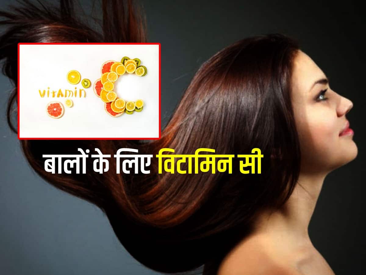 Vitamin C से दूर करें बालों की ये 5 समस्याएं, जानें हेल्दी हेयर के लिए  कितना है जरूरी  हिंदी