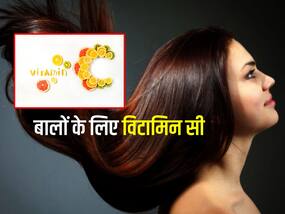 Vitamin C से दूर करें बालों की ये 5 समस्याएं, जानें हेल्दी हेयर के लिए कितना है जरूरी