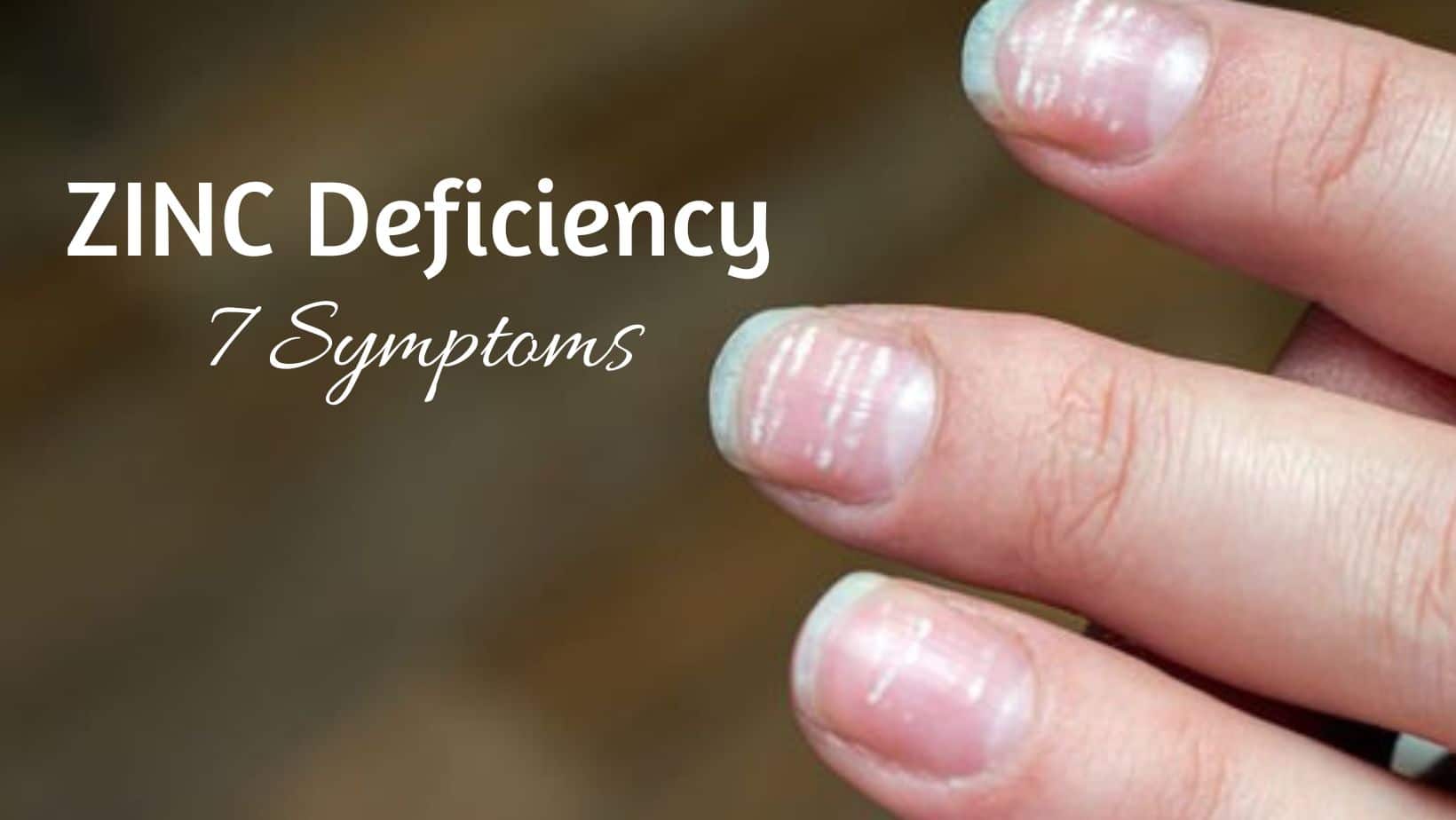 When Vitamin And Nutritional Deficiencies Cause Skin And Nail Changes