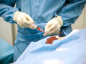 Confusing 'A' Procedures After Heart Attack: Know The Difference Between Angiography And Angioplasty