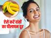 दांतों के पीलेपन से परेशान? इस फल के छिलके से सफेद चमकने लगेंगे दांत, जानें पाउडर बनाने का तरीका