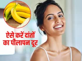 दांतों के पीलेपन से परेशान? इस फल के छिलके से सफेद चमकने लगेंगे दांत, जानें पाउडर बनाने का तरीका
