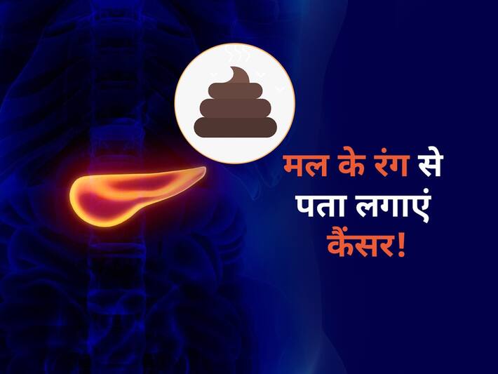 Signs of cancer in stool मल (Potty) का रंग बता देगा शरीर के इस हिस्से