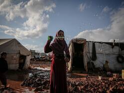 COVID, Monkeypox And Now Cholera: Know What Is Driving The Outbreak Of This Water-borne Disease