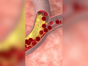 हाई कोलेस्ट्रॉल के लिए बेस्ट हैं ये 8 फूड्स