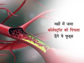 नसों में जमे कोलेस्ट्रॉल को बर्फ की तरह पिघला देंगे ये फूड्स, जानें वे 5 चीजें जिन्हें डाइट में करना चाहिए शामिल