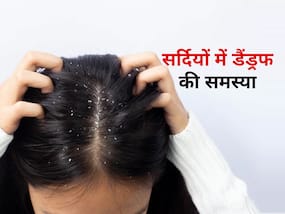 सर्दियों में बढ़ सकती है डैंड्रफ की समस्या, इस्तेमाल करें ये 4 चीजें